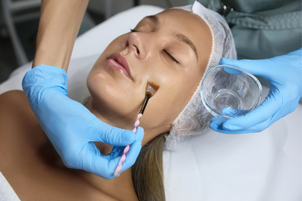 Chemical Peels vs Laser Treatments Which Is Better